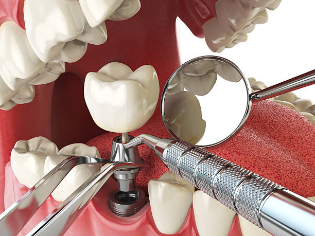 Best Emergency Tooth Extraction in , NC